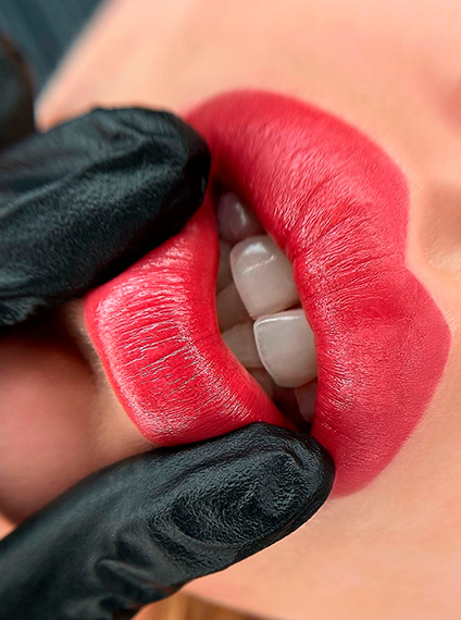 Resultado Harmonioso