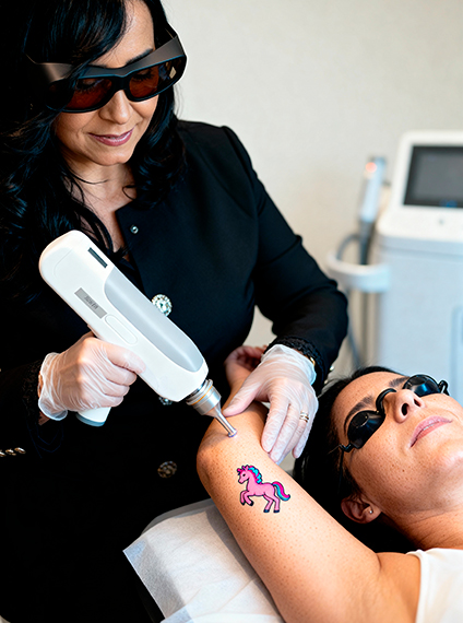 Remoção de Tatuagem